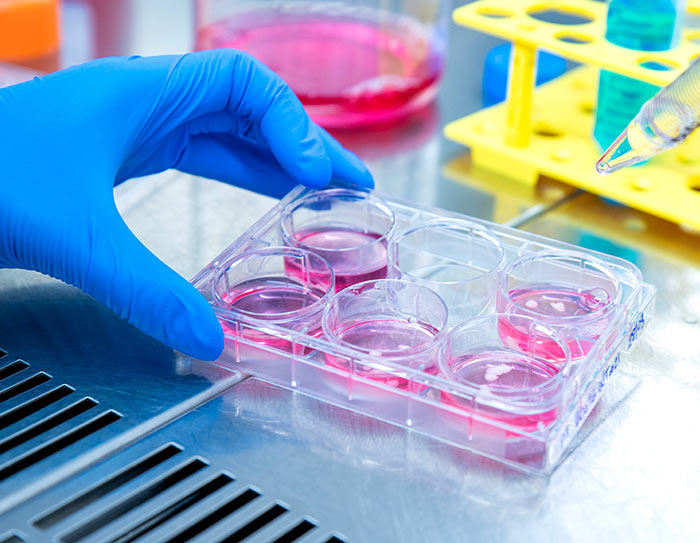 rare neuromuscular diseases