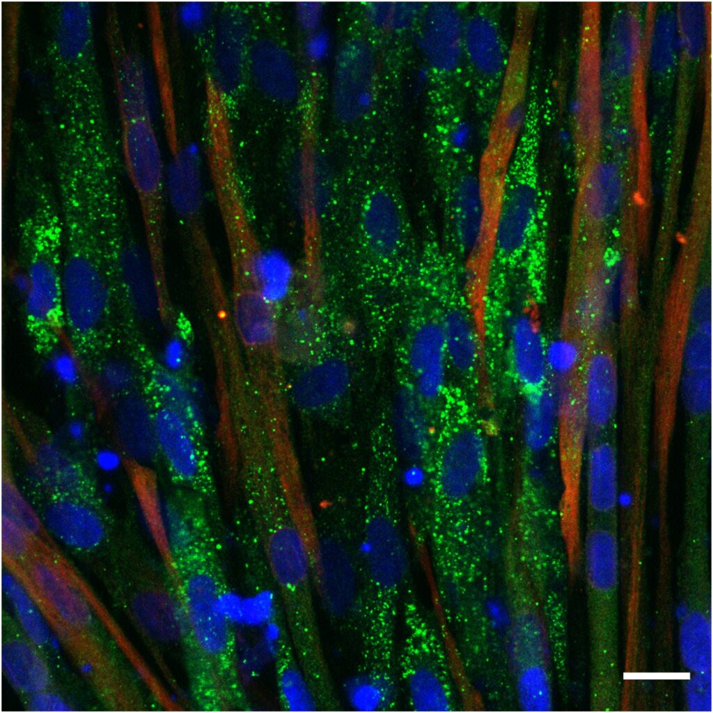 autophagy