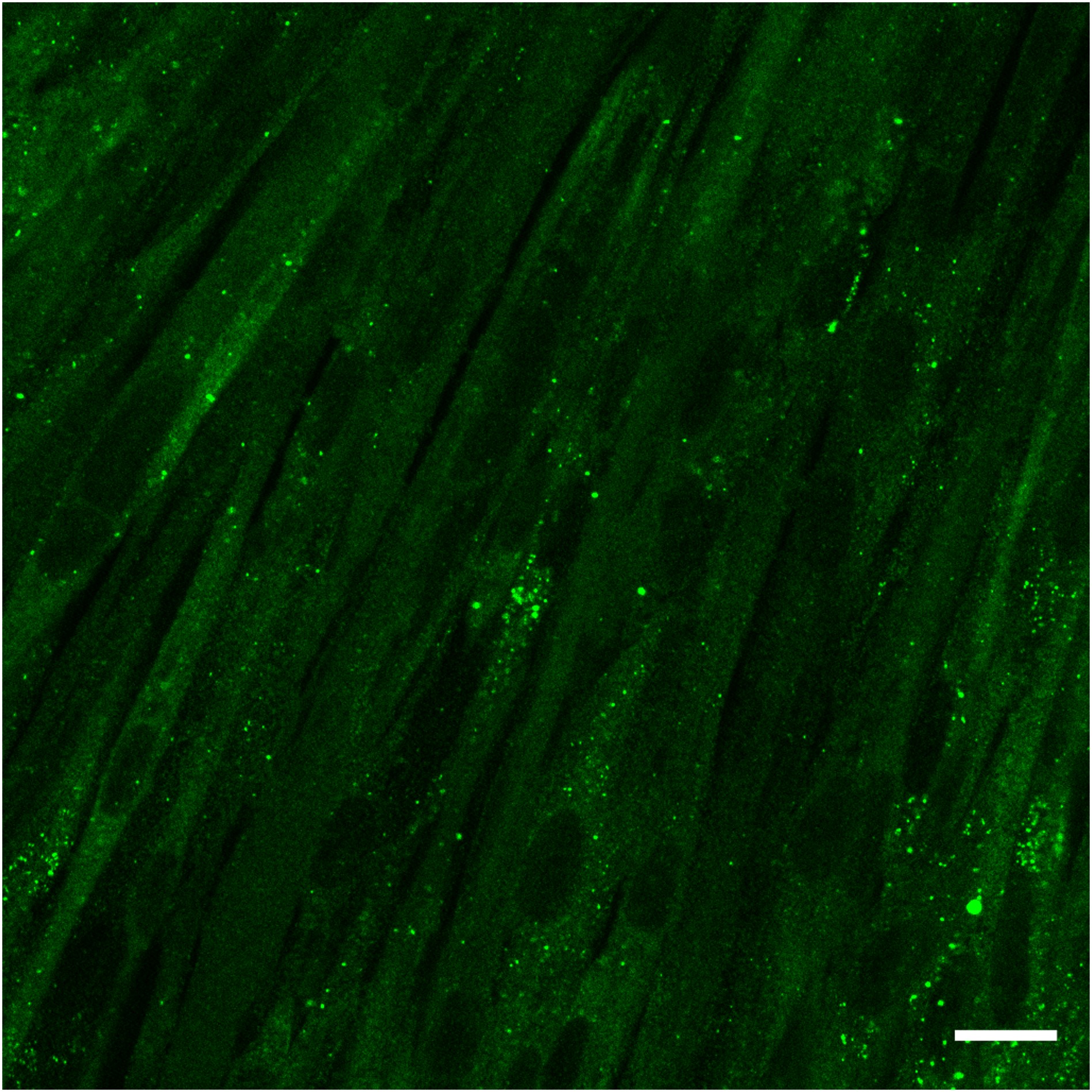 autophagy