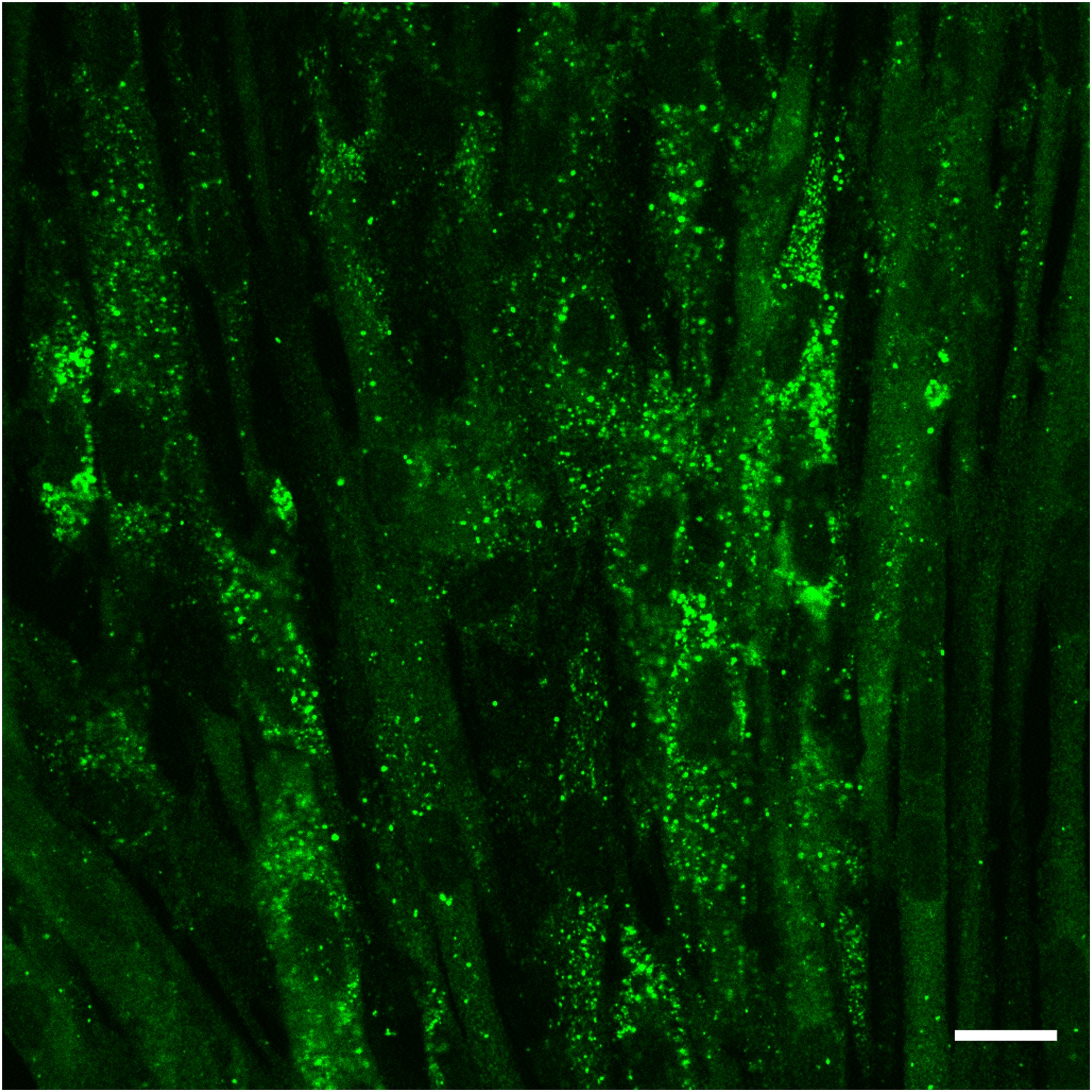 autophagy