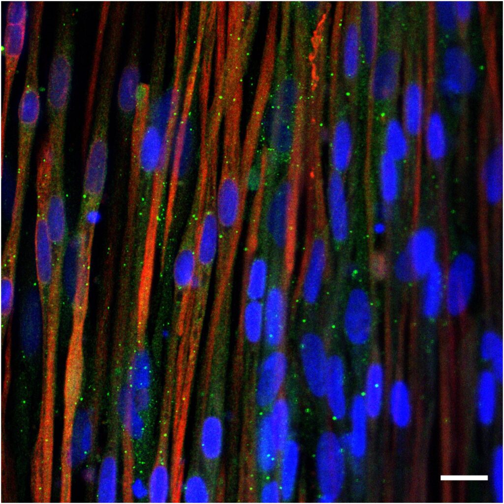 autophagy